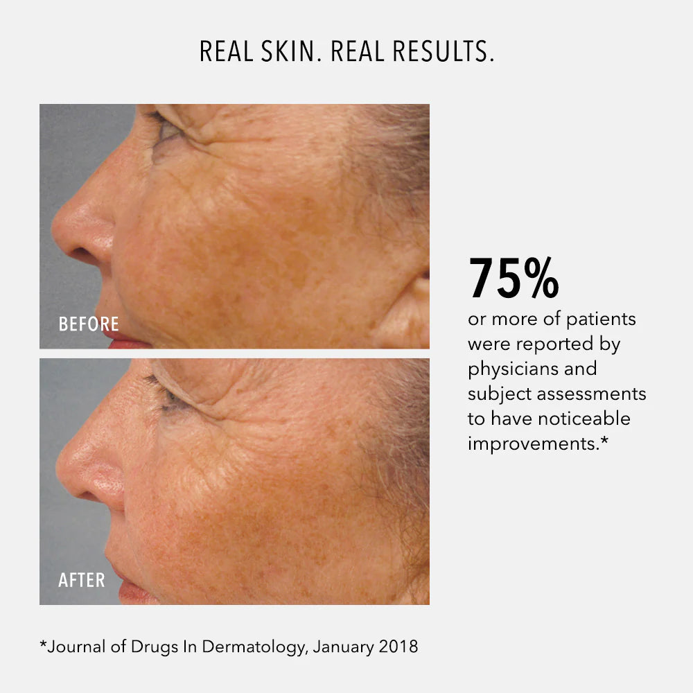 Lumapro-C Serum by Hydro-Peptide